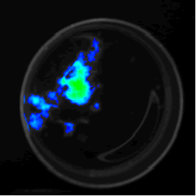 Laboratory grown lung tumors glowing with Green Fluorescent Protein